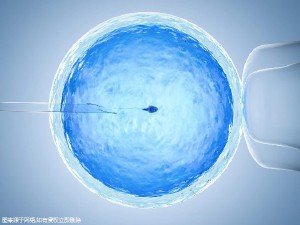 极光生殖